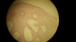 MISSING THUMBNAIL